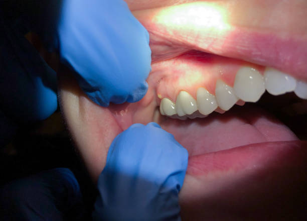 Best Walk-In Emergency Dentist in Versailles, MO