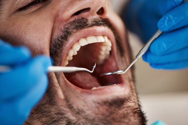 Best Emergency Broken Tooth Repair in Versailles, MO
